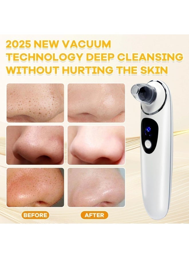 general 2025 Pore Vacuum with Camerafor, USB Rechargeable Blackhead Remover Vacuum,3 Levels Adjustable Pore Vacuum Blackhead Remover, 6 Suction Heads,Face Vacuum Pore Cleanser for Women & Men-Light Purple - Image 5